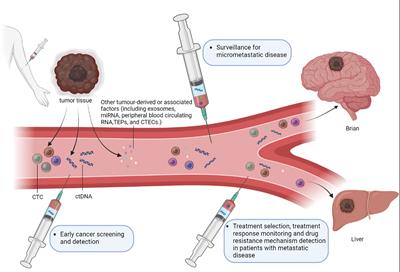 Circulating tumor DNA detection in MRD assessment and diagnosis and treatment of non-small cell lung cancer